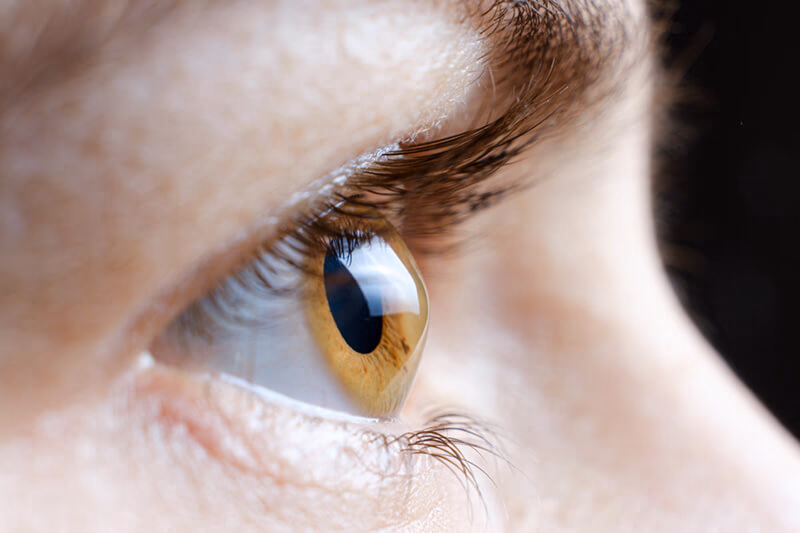 The Silent Epidemic: Why Every Child Needs a Keratoconus Screening