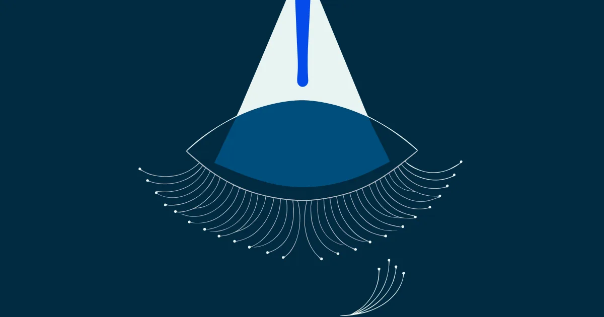 Can IPL Dry Eye Treatment Cause Eyelash Loss? What to Know About Recovery