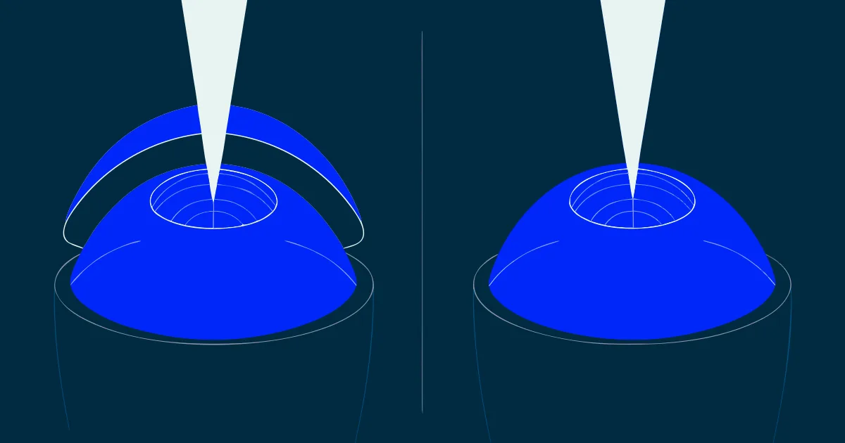 LASIK vs. PRK: Which Laser Vision Correction is Right for You?