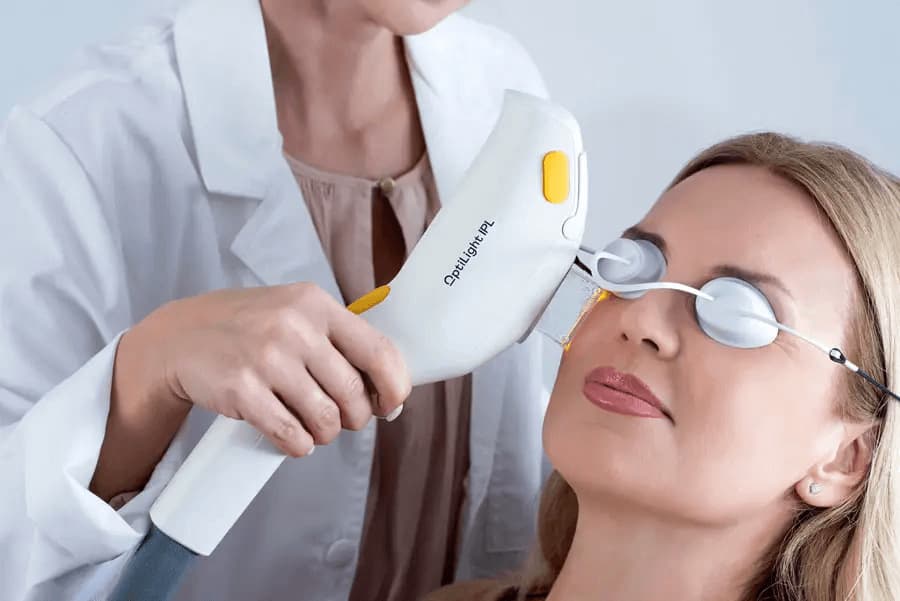 IPL treatment for dry eye caused by meibomian gland dysfunction