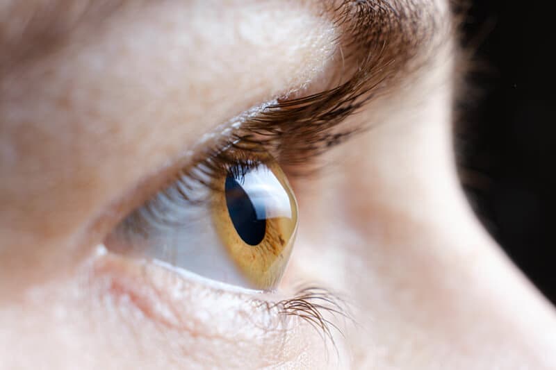 Living with Keratoconus: A Comprehensive Patient's Guide