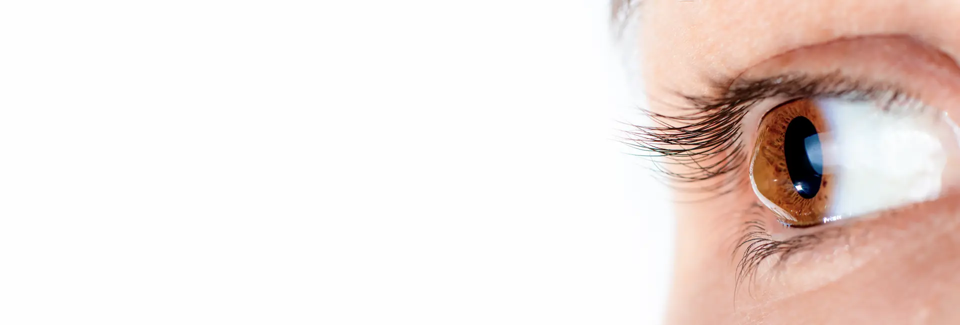 Keratoconus Treatment in Emerald Bay